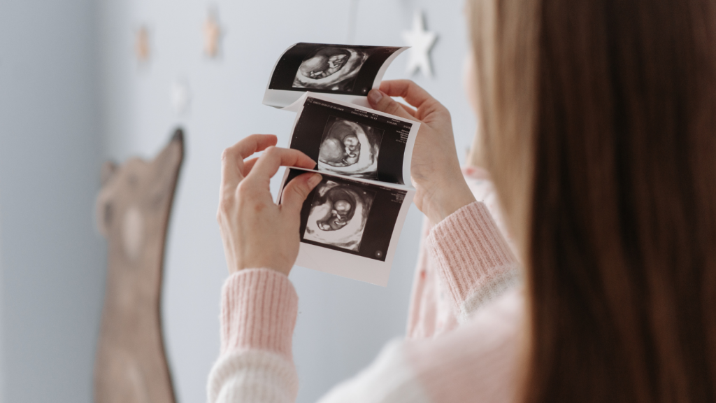 pregnant person holding sonogram images
